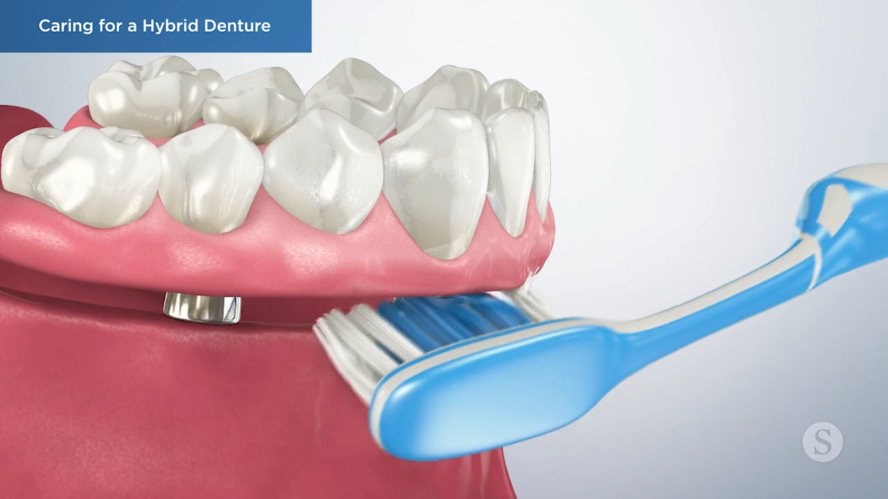 Caring for a Hybrid Denture Video Thumbnail