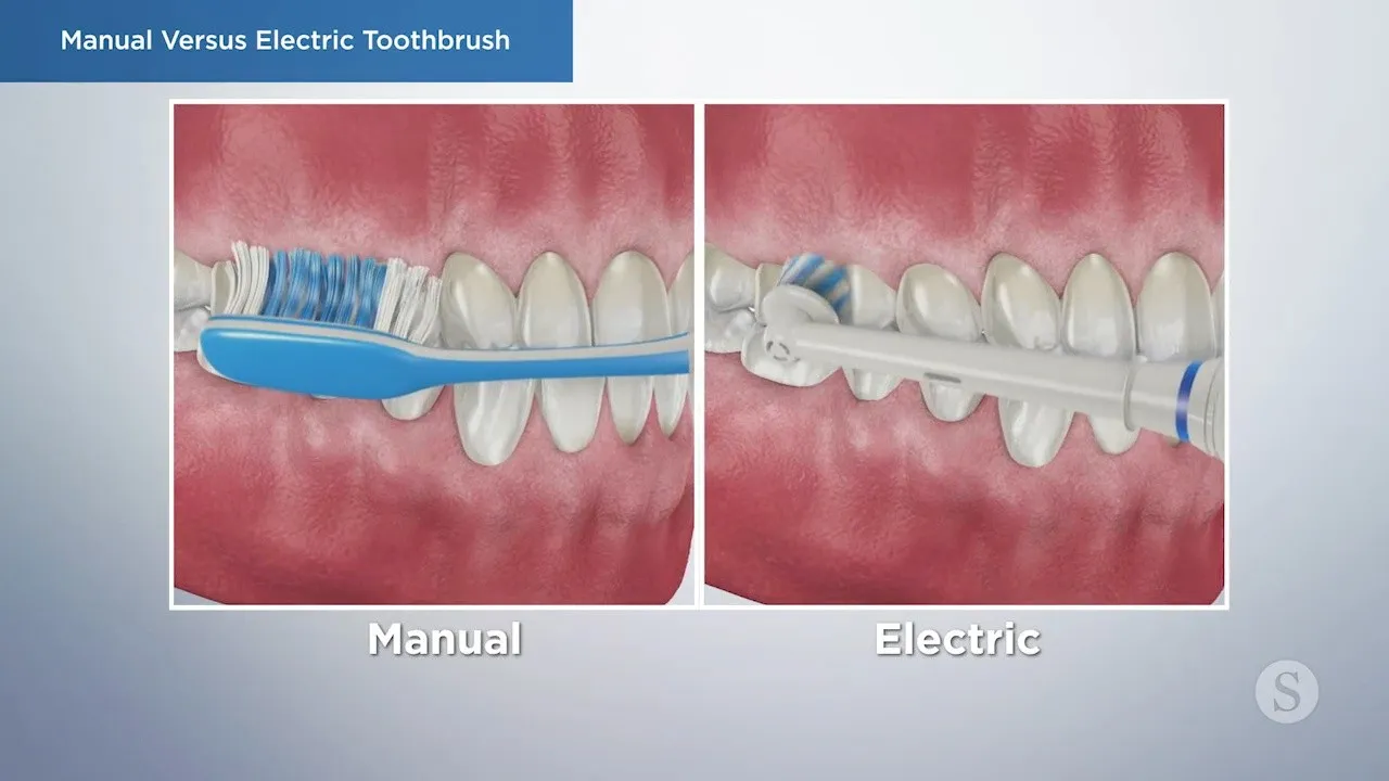 Manual vs Electric Toothbrush Video Thumbnail