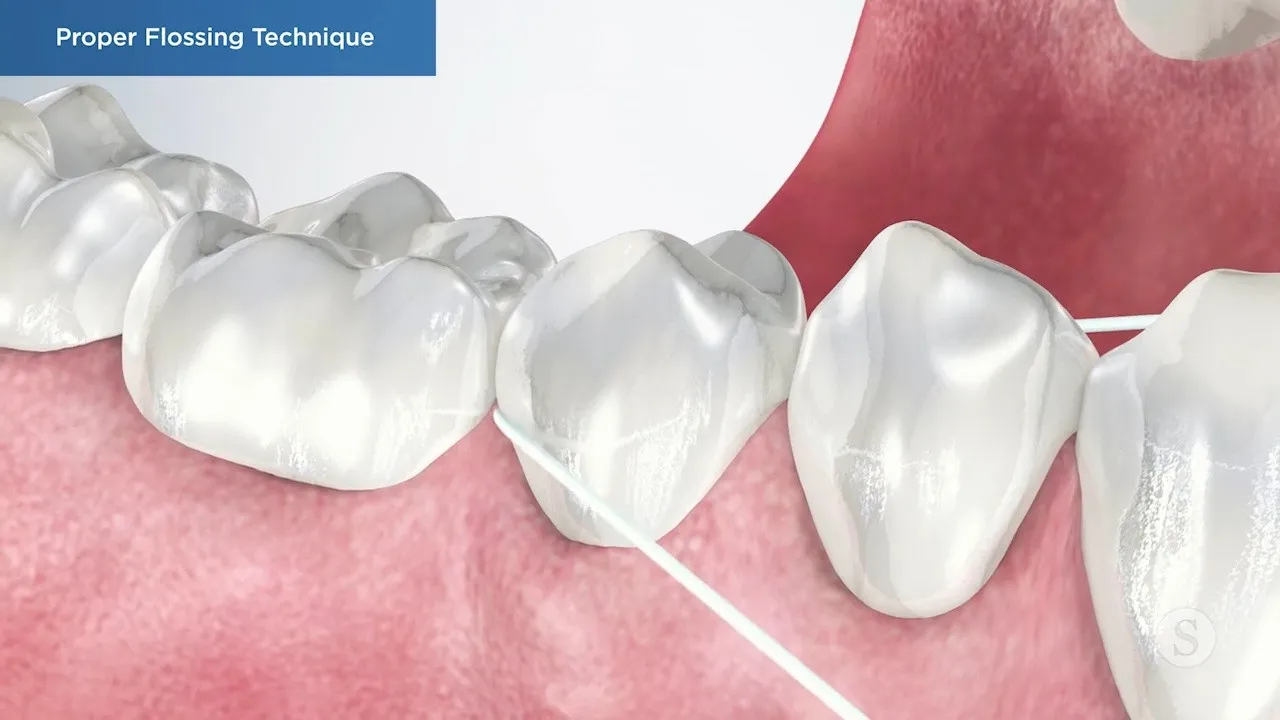 Proper Flossing Technique Video Thumbnail
