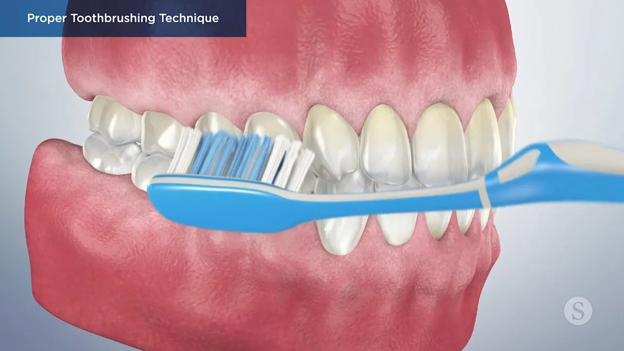 Proper Toothbrushing Technique Video Thumbnail