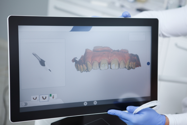 Image from the Trios Intraoral scanner creating a digital image of your teeth, no impressions